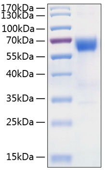Recombinant Human TNFRSF10D/DcR2/TRAIL-R4/CD264 Protein was determined by SDS-PAGE under reducing conditions with Coomassie Blue.