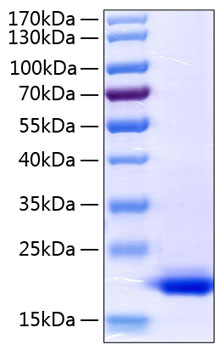 Recombinant Human TNF-alpha Protein was determined by SDS-PAGE under reducing conditions with Coomassie Blue.