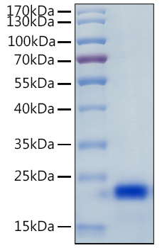 Recombinant Human IL-4 Protein was determined by SDS-PAGE under reducing conditions with Coomassie Blue.
