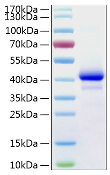 Recombinant Human IGF-I Protein was determined by SDS-PAGE under reducing conditions with Coomassie Blue.