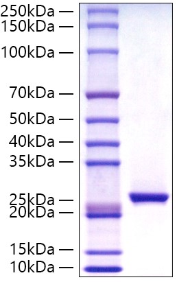 Recombinant Human C-Reactive Protein/CRP Protein was determined by SDS-PAGE under reducing conditions with Coomassie Blue.
