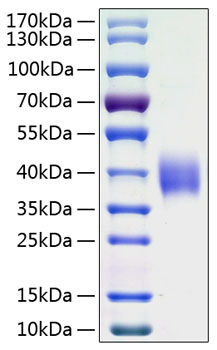 Recombinant Human B7-H3/CD276 Protein was determined by SDS-PAGE under reducing conditions with Coomassie Blue.
