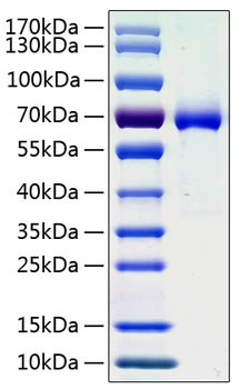 Recombinant Human Ephrin-A3/EFNA3 Protein was determined by SDS-PAGE under reducing conditions with Coomassie Blue.