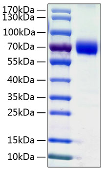 Recombinant Human B7-H5/Gi24/VISTA Protein was determined by SDS-PAGE under reducing conditions with Coomassie Blue.