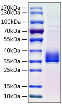 Recombinant Human Angiopoietin-like 3/ANGPTL3(17-220) Protein was determined by SDS-PAGE under reducing conditions with Coomassie Blue.