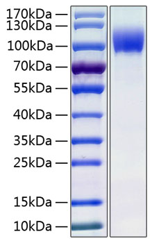 Recombinant Human IL-13RA1/CD213a1 Protein was determined by SDS-PAGE under reducing conditions with Coomassie Blue.