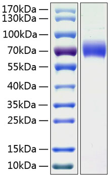 Recombinant Human Kininogen-1/KNG1 Protein was determined by SDS-PAGE under reducing conditions with Coomassie Blue.
