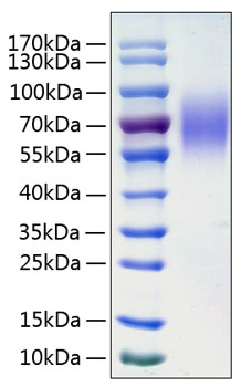 Recombinant Human LAMP-1/CD107a Protein was determined by SDS-PAGE under reducing conditions with Coomassie Blue.