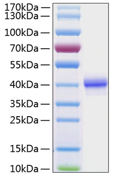 Recombinant Human EGF Protein was determined by SDS-PAGE under reducing conditions with Coomassie Blue.