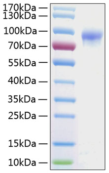 Recombinant Human IL-2RG/CD132 Protein was determined by SDS-PAGE under reducing conditions with Coomassie Blue.