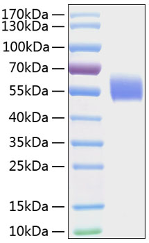 Recombinant Human IL-1R1/CD121a Protein was determined by SDS-PAGE under reducing conditions with Coomassie Blue.