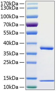 Recombinant Human FcRn/FCGRT&amp;B2M Protein was determined by SDS-PAGE under reducing conditions with Coomassie Blue.