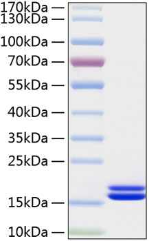 Recombinant Human IL-2 Protein was determined by SDS-PAGE under reducing conditions with Coomassie Blue.