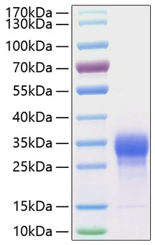 Recombinant Human IL-7 Protein was determined by SDS-PAGE under reducing conditions with Coomassie Blue.