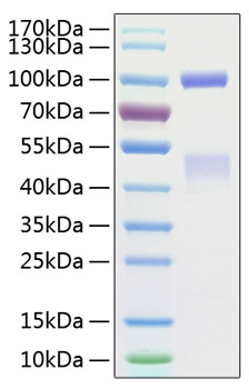 Recombinant Human HGF receptor/c-MET/MET Protein was determined by SDS-PAGE under reducing conditions with Coomassie Blue.