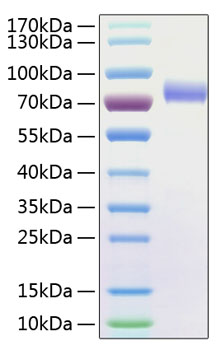 Recombinant Human Fc-gamma RIII alpha/FCGR3A /CD16a Protein was determined by SDS-PAGE under reducing conditions with Coomassie Blue.