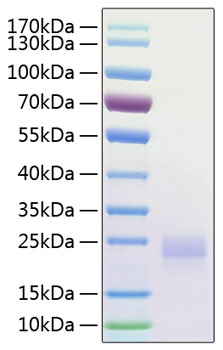 Recombinant Human CTLA-4/CD152 Protein was determined by SDS-PAGE under reducing conditions with Coomassie Blue.