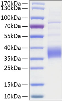 Recombinant Human TROP-2/TACSTD2 Protein was determined by SDS-PAGE under reducing conditions with Coomassie Blue.