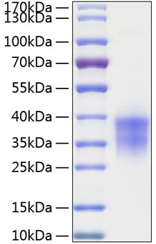Recombinant Human TWSG1 Protein was determined by SDS-PAGE under reducing conditions with Coomassie Blue.
