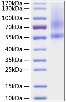 Recombinant Human Testican-1/SPOCK1 Protein was determined by SDS-PAGE under reducing conditions with Coomassie Blue.