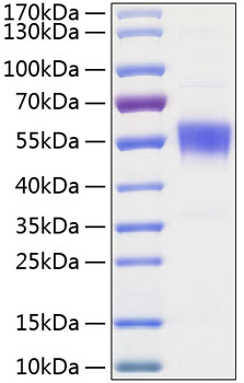 Recombinant Human BTLA/CD272 Protein was determined by SDS-PAGE under reducing conditions with Coomassie Blue.
