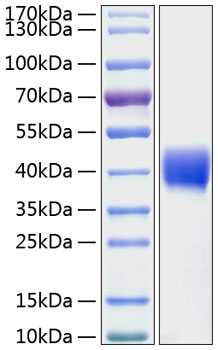 Recombinant Human Mesothelin/MSLN Protein was determined by SDS-PAGE under reducing conditions with Coomassie Blue.