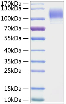Recombinant Mouse P-Selectin/SELP/CD62P Protein was determined by SDS-PAGE under reducing conditions with Coomassie Blue.