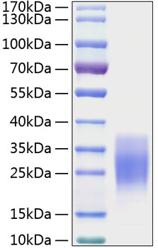 Recombinant Mouse c-Kit ligand/KITLG/SCF Protein was determined by SDS-PAGE under reducing conditions with Coomassie Blue.