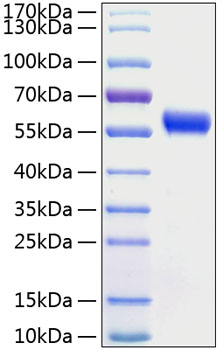 Recombinant Human Frizzled-5/FZD5 Protein was determined by SDS-PAGE under reducing conditions with Coomassie Blue.