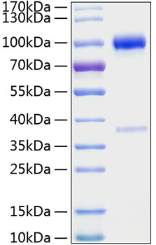 Recombinant Mouse TNFRSF11B/Osteoprotegerin Protein was determined by SDS-PAGE under reducing conditions with Coomassie Blue.