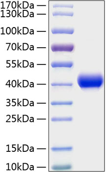 Recombinant Mouse CXCL16/SR-PSOX Protein was determined by SDS-PAGE under reducing conditions with Coomassie Blue.