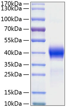 Recombinant Mouse Dkk-1 Protein was determined by SDS-PAGE under reducing conditions with Coomassie Blue.