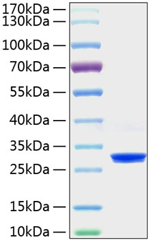 Recombinant Mouse C-Reactive Protein/CRP Protein was determined by SDS-PAGE under reducing conditions with Coomassie Blue.