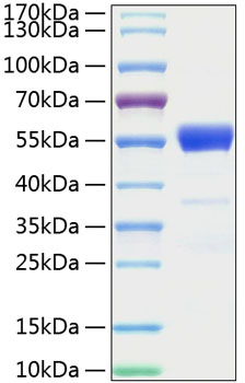 Recombinant Mouse IFN-gamma Protein was determined by SDS-PAGE under reducing conditions with Coomassie Blue.