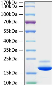 Recombinant Mouse TNF-alpha Protein was determined by SDS-PAGE under reducing conditions with Coomassie Blue.