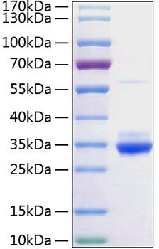 Recombinant Rat C-Reactive Protein/CRP Protein was determined by SDS-PAGE under reducing conditions with Coomassie Blue.