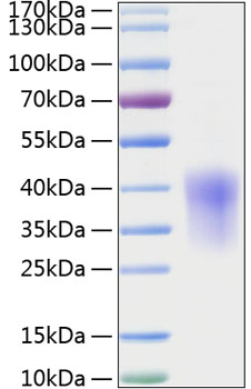 Recombinant Rat CCL2/MCP-1 Protein was determined by SDS-PAGE under reducing conditions with Coomassie Blue.
