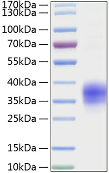 Recombinant Mouse TNFRSF1A/TNF-R1/CD120a Protein was determined by SDS-PAGE under reducing conditions with Coomassie Blue.