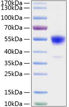 Recombinant Rat IFN-gamma Protein was determined by SDS-PAGE under reducing conditions with Coomassie Blue.
