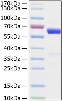 Recombinant Mouse IFN-beta Protein was determined by SDS-PAGE under reducing conditions with Coomassie Blue.
