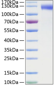 Recombinant Mouse E-selectin/SELE/CD62E Protein was determined by SDS-PAGE under reducing conditions with Coomassie Blue.