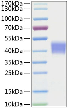 Recombinant Mouse IL-21R/CD360 Protein was determined by SDS-PAGE under reducing conditions with Coomassie Blue.