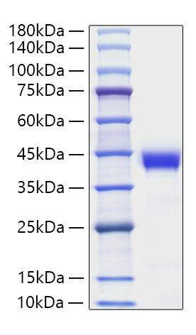 Recombinant Human Zinc-alpha-2-glycoprotein/AZGP1 Protein was determined by SDS-PAGE under reducing conditions with Coomassie Blue.