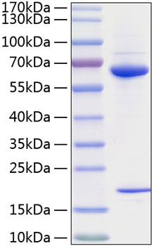 Recombinant Human PCSK9 Protein was determined by SDS-PAGE under reducing conditions with Coomassie Blue.