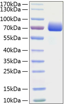 Recombinant Mouse B7-H1/PD-L1/CD274 Protein was determined by SDS-PAGE under reducing conditions with Coomassie Blue.