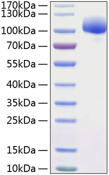 Recombinant Human FGFR-1/FLT-2/CD331 Protein was determined by SDS-PAGE under reducing conditions with Coomassie Blue.