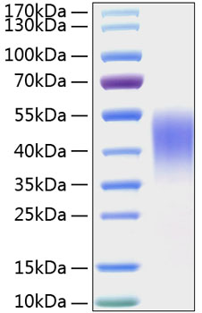 Recombinant Mouse TIM-3/HAVCR2/CD366 Protein was determined by SDS-PAGE under reducing conditions with Coomassie Blue.