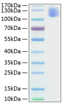 Recombinant Human CEACAM5/CEA/CD66e Protein was determined by SDS-PAGE under reducing conditions with Coomassie Blue.