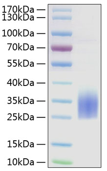 Recombinant Human TREM2 Protein was determined by SDS-PAGE under reducing conditions with Coomassie Blue.