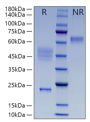 Recombinant Human IL-23/IL-12B&amp;IL-23A Protein was determined by SDS-PAGE under reducing (R) and non-reducing (NR) conditions.
